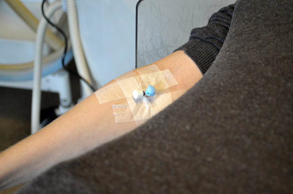 Laserbehandling, Skin Care Academy, Acne-ärr