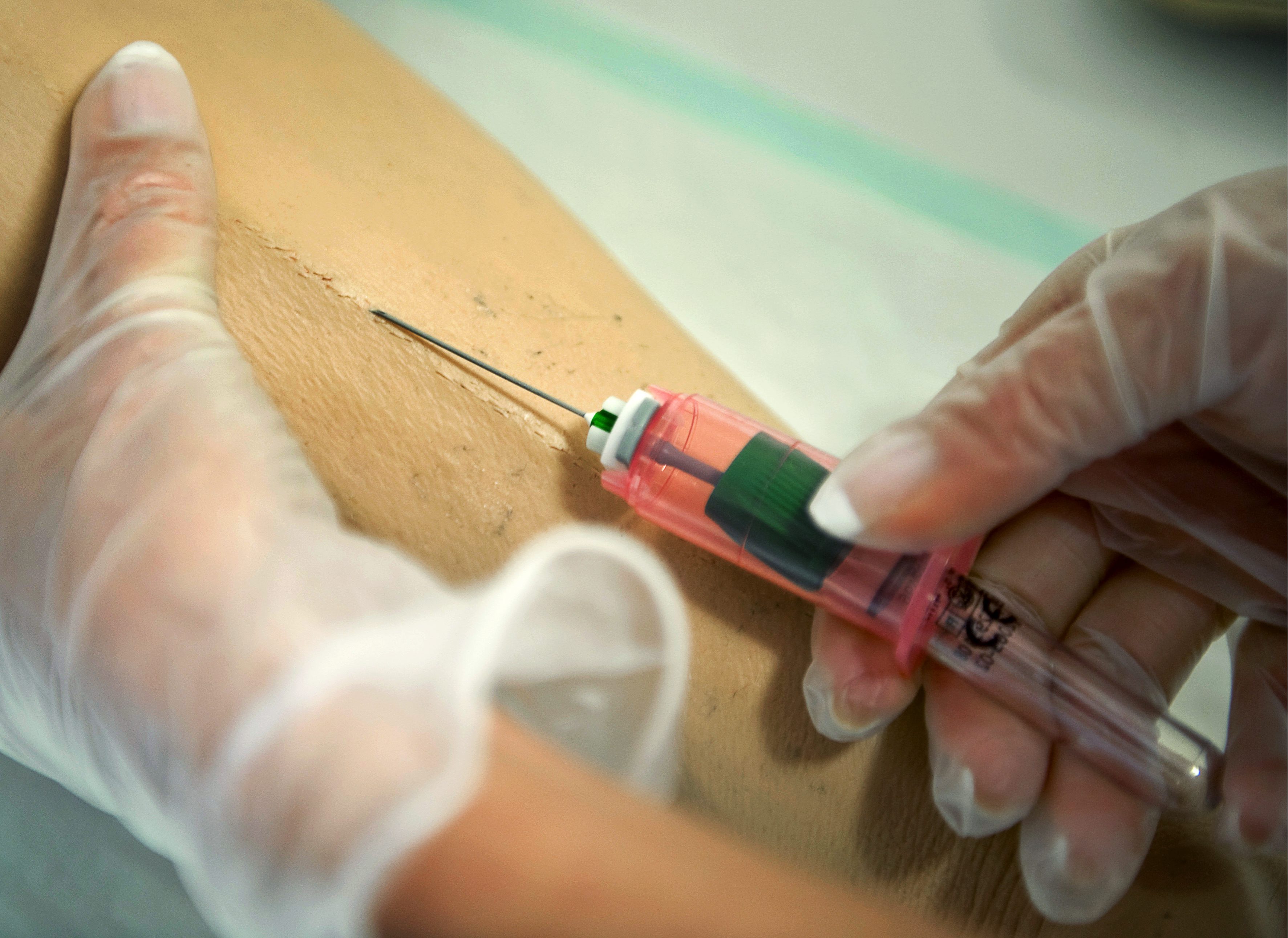 Lakare, HIV, Stämd, USA, HIV-smittad