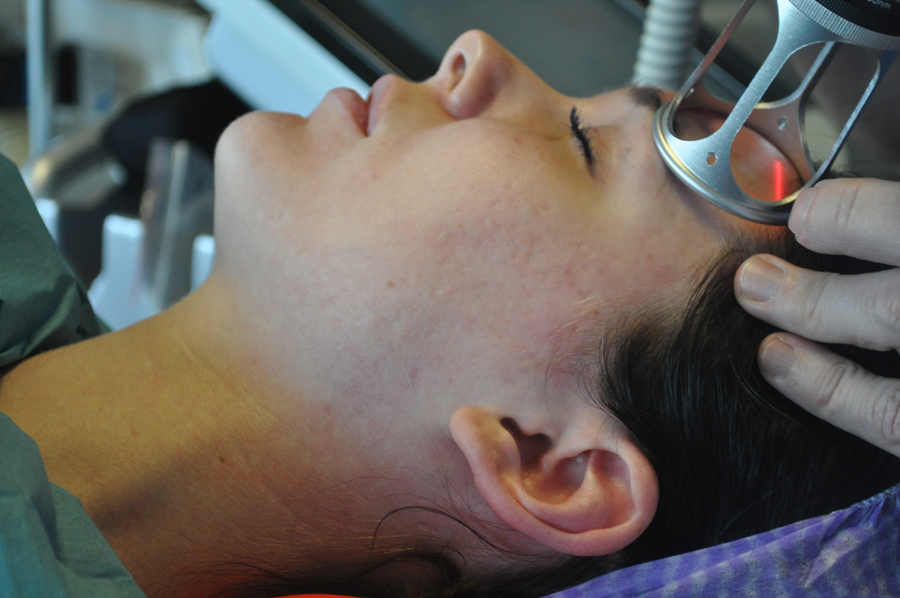 Laserbehandling, Acne-ärr, Skin Care Academy