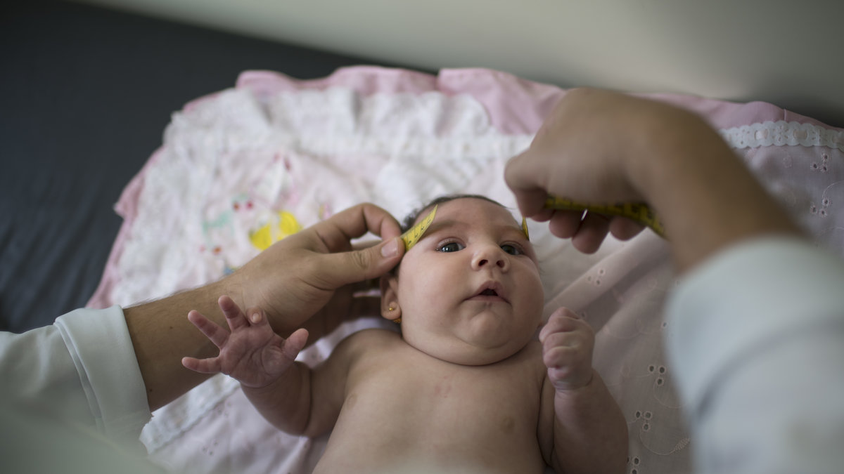 Lilla Luizia får sitt huvud mätt på ett sjukhus i Brasilien. 