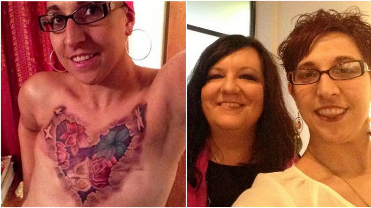 Hennes selfie inspirerar andra cancerdrabbade kvinnor. 