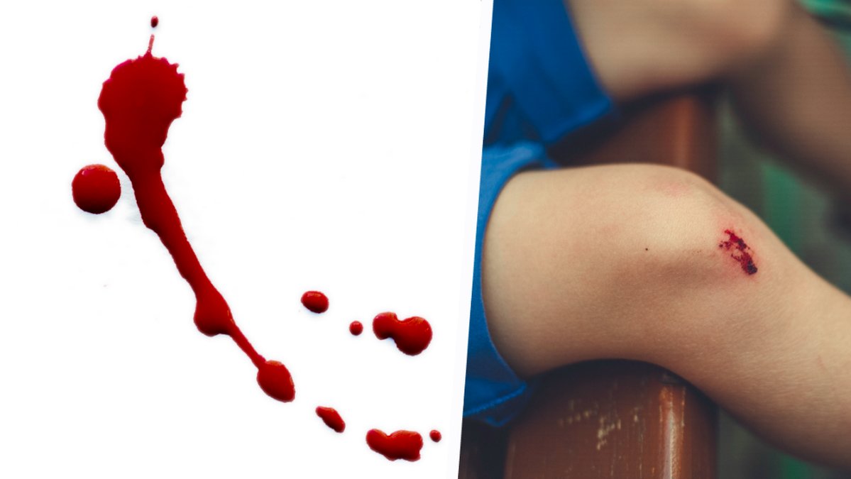 En blodfläck. Till höger ett barn med skadat knä. Kollage