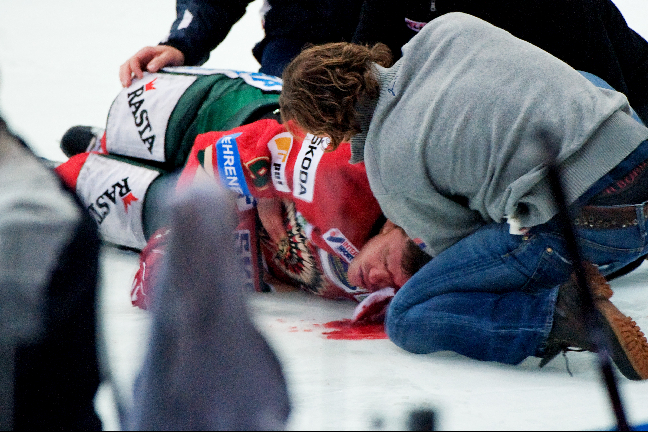 Blodet forsade efter att Kahnberg knockats av Sebastian Karlsson.