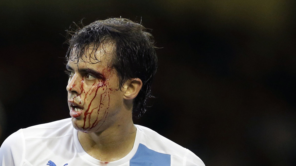 Diego Rodriguez hade därmed inte bara sitt ögonbryn att vara ledsen för efter matchen mot Storbritannien.