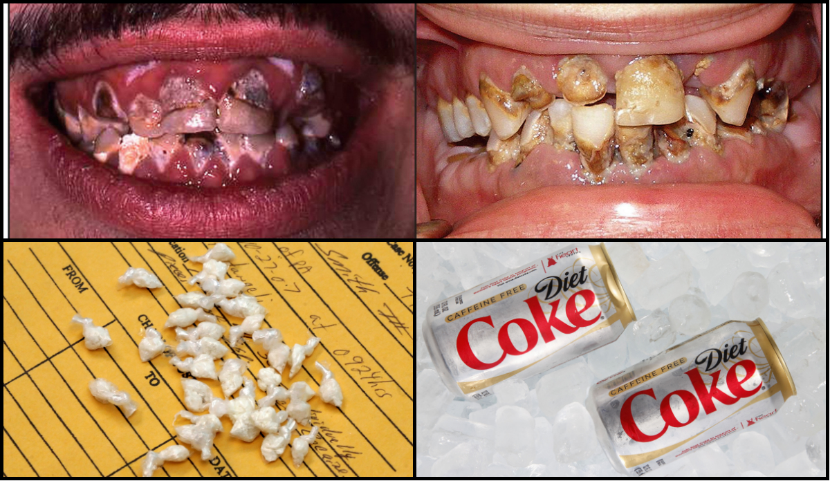 Tandhälsa, Metamfetamin, Crack, lightläsk, Forskning, Droger, Karies