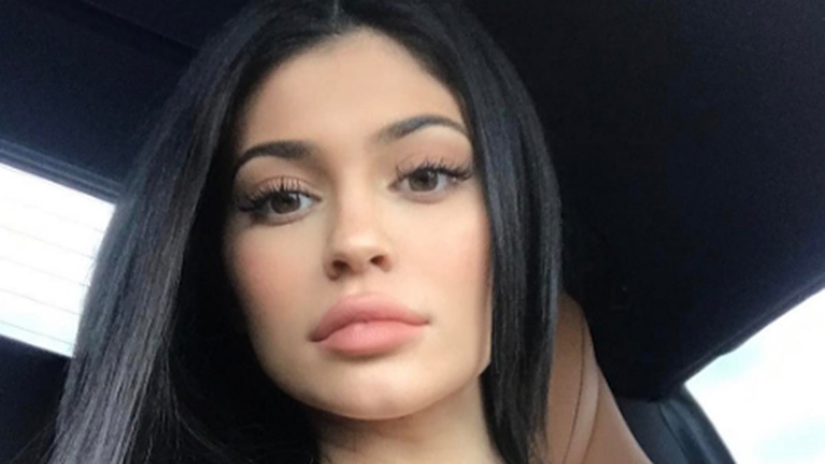 Kylie Jenner själv hävdar att hon bara har gör fillers i läpparna. 