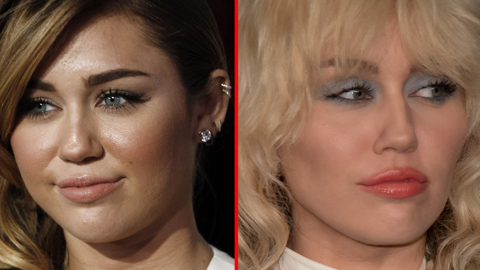 Buccal fat removal 11 kändisar före och efter operationen