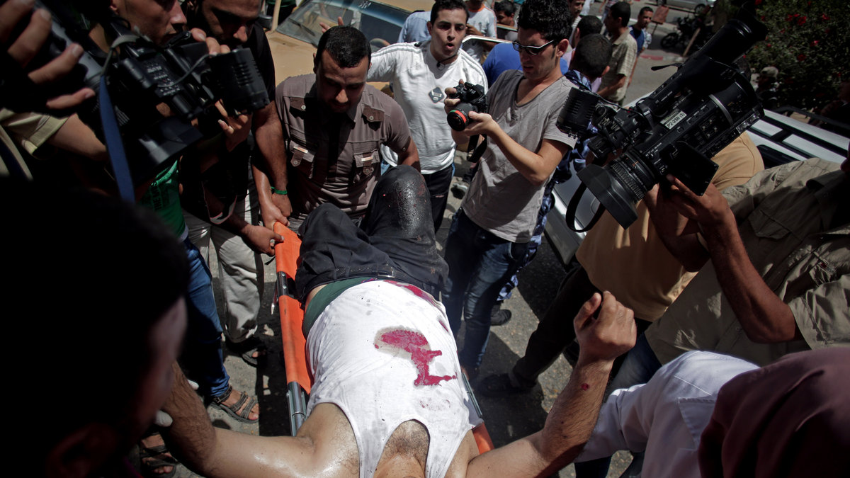 En bombskadad man i Gaza förs till sjukhus. 
