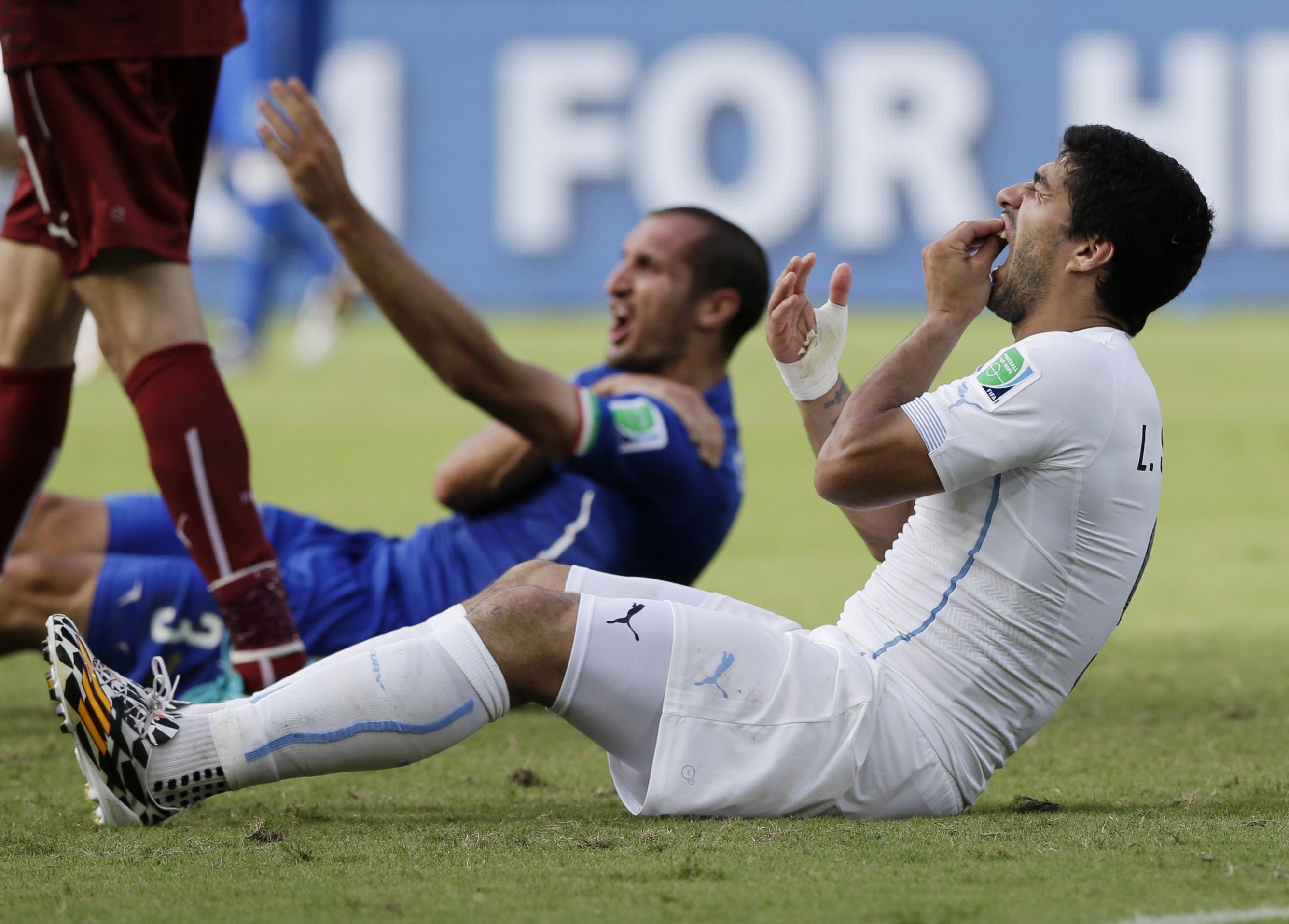 Luis Suárez var nära tårar av smärta efter hans bett i Chellinis axel. 