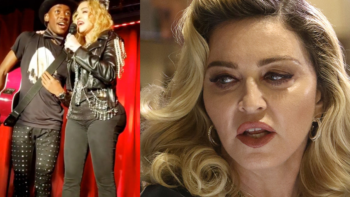 Madonna har gjort rumpoperation.