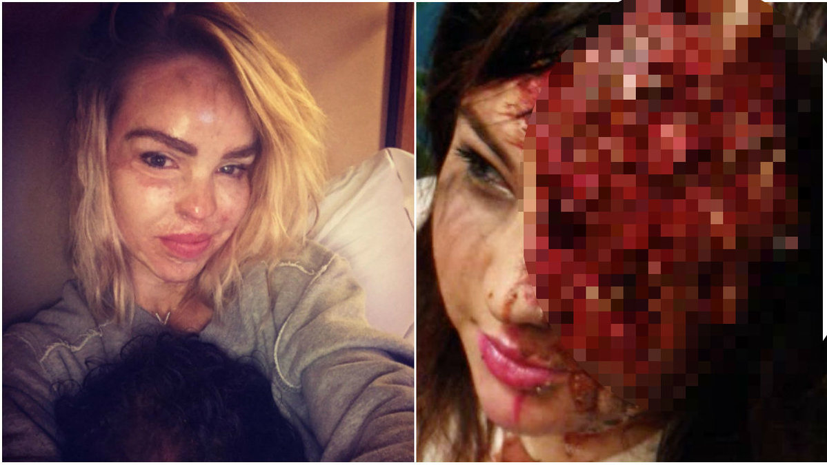 Blodiga make ups har blivit något av en trend. Klicka dig vidare i bildspelet för läskiga bilder på make up-tutorials. 
