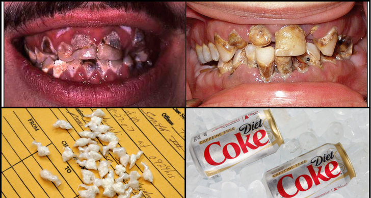 Crack, Tandhälsa, lightläsk, Karies, Droger, Metamfetamin, Forskning