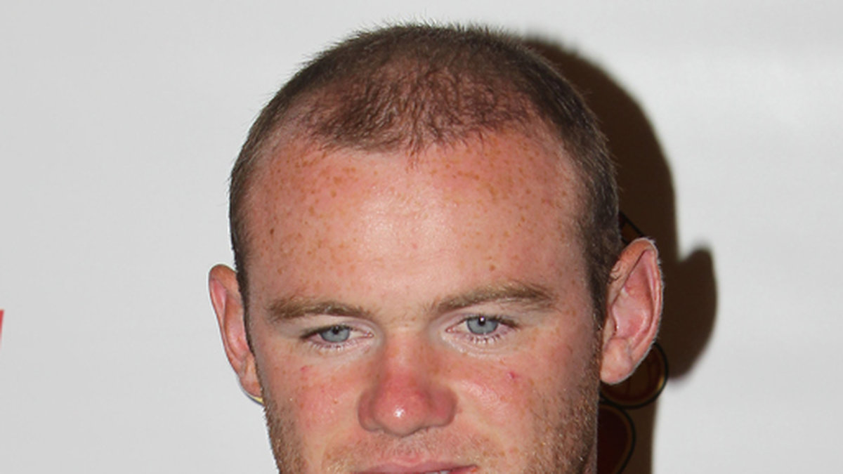 Wayne Rooney har även han berättat att han gjort en hårtransplantation. 