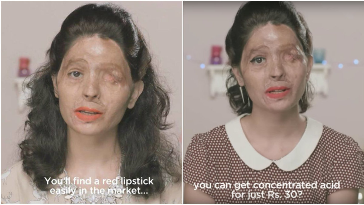 Reshma fick syra kastad i ansiktet men hon lät inte det ta ifrån henne varken hennes mod, röst eller skönhet. 