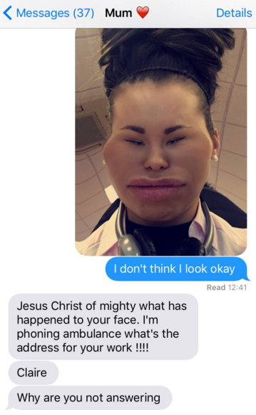 Varför Fungerar Inte Snapchat