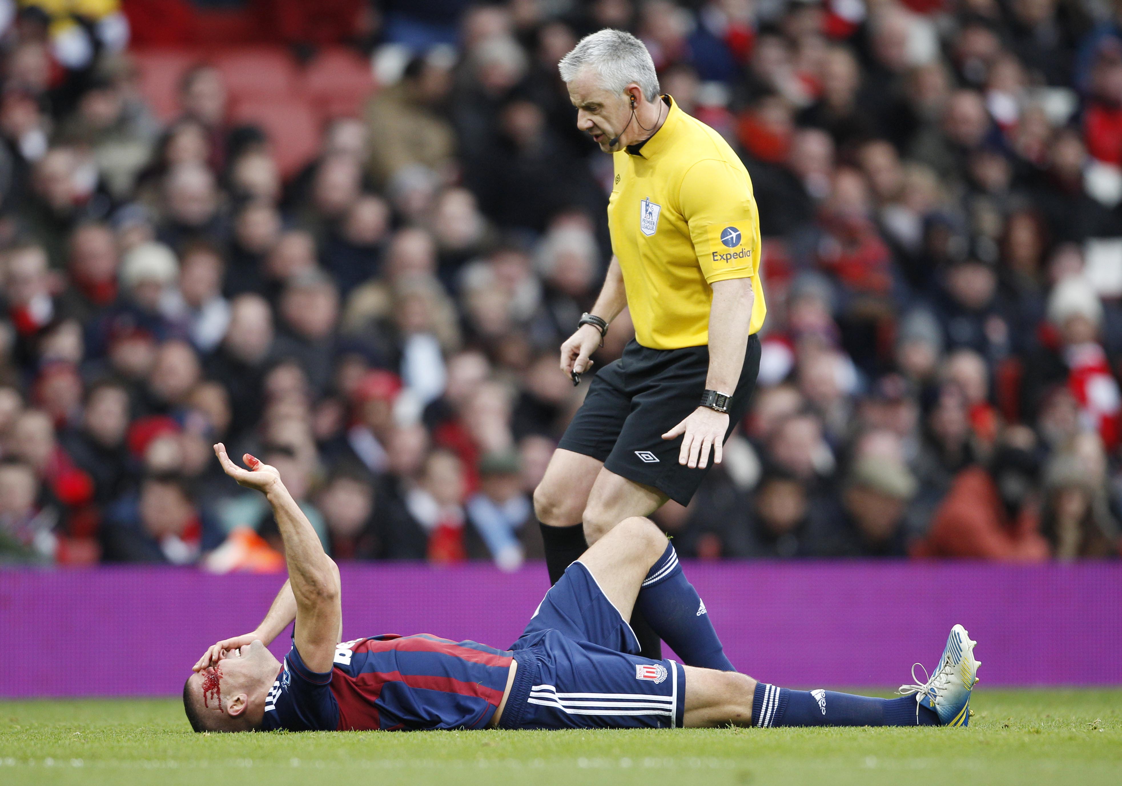 Jonathan Walters fick en rejäl armbåge i Stoke match mot Arsenal. Jonathan Walters fick en rejäl armbåge i Stoke match mot Arsenal.