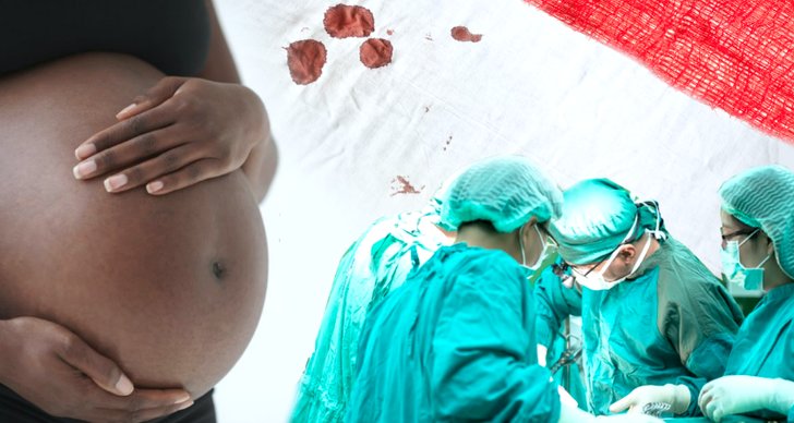 Graviditet, Förlossningsskador