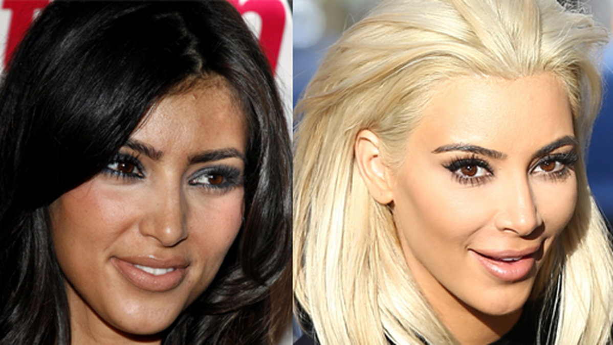 Kim Kardashians ansikte har förändrats rejält genom åren. 