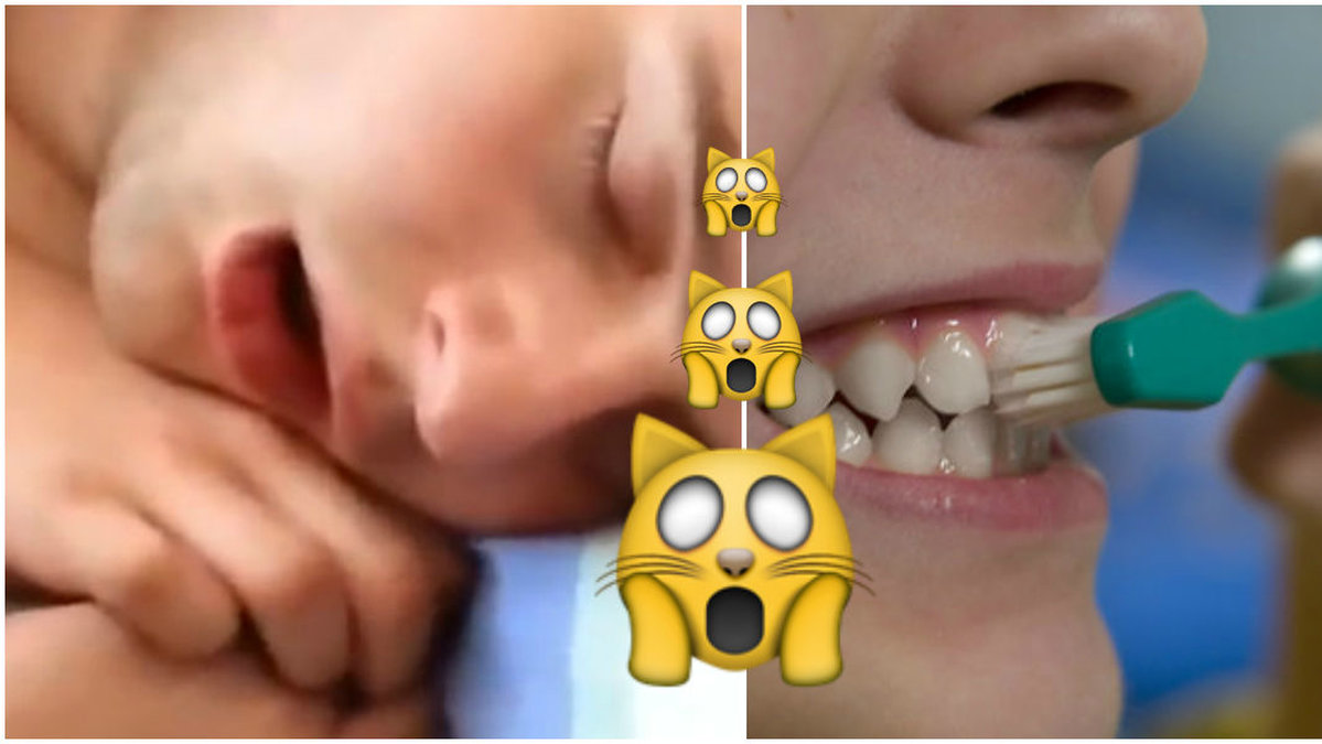 Dåliga tänder och snarkningar kan vara tecken på sjukdom.