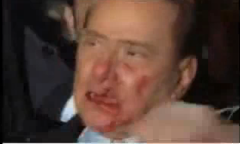 En blodig Berlusconi efter attacken i Milano.