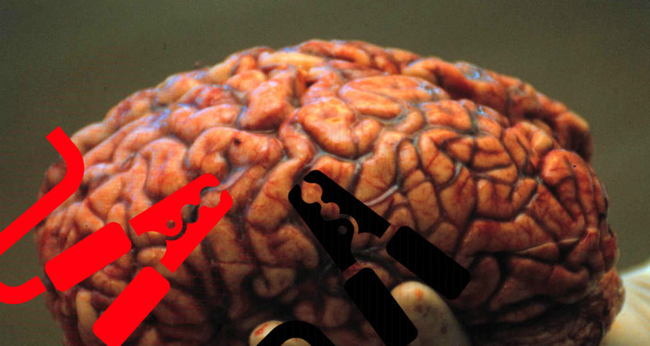 Hjärnan, Vetenskap, Koma