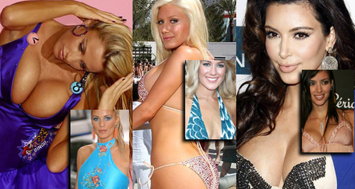 Operationer, Pamela Anderson, Kim Kardashian, Skonhet