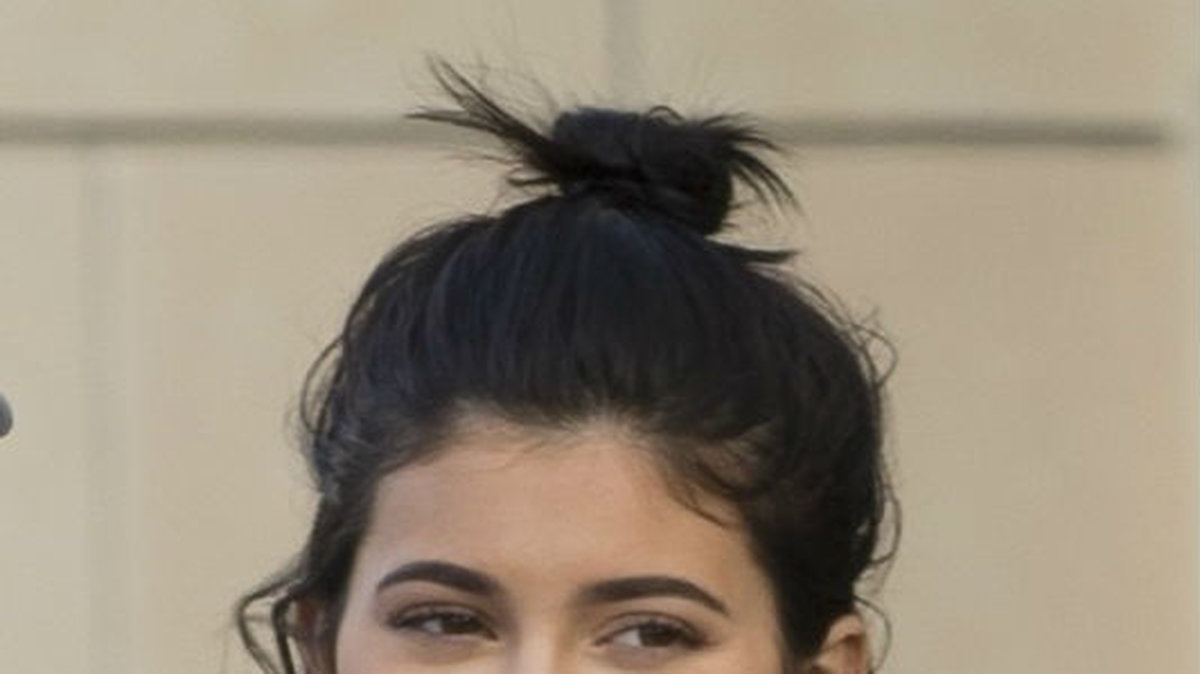 Kylie Jenner med sina nya läppar. 