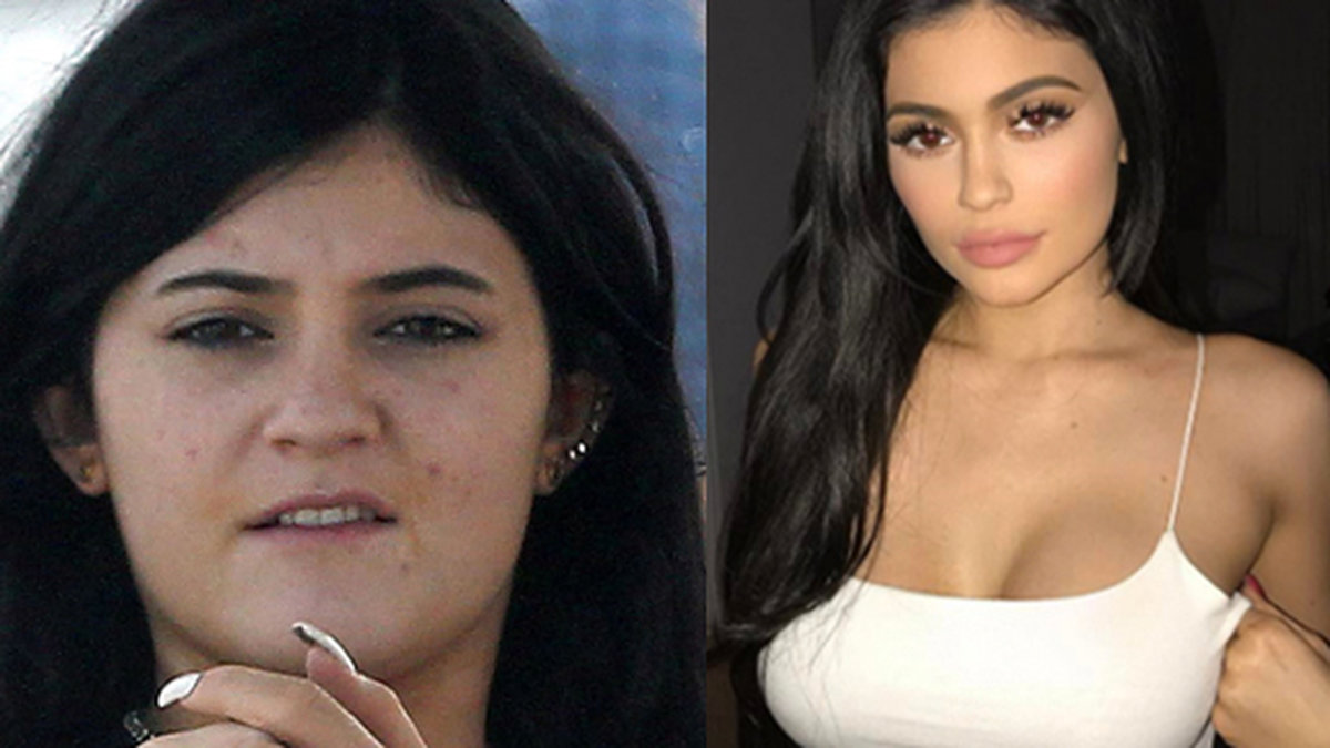 Kylie Jenner har förändrats en hel del under de senaste åren...
