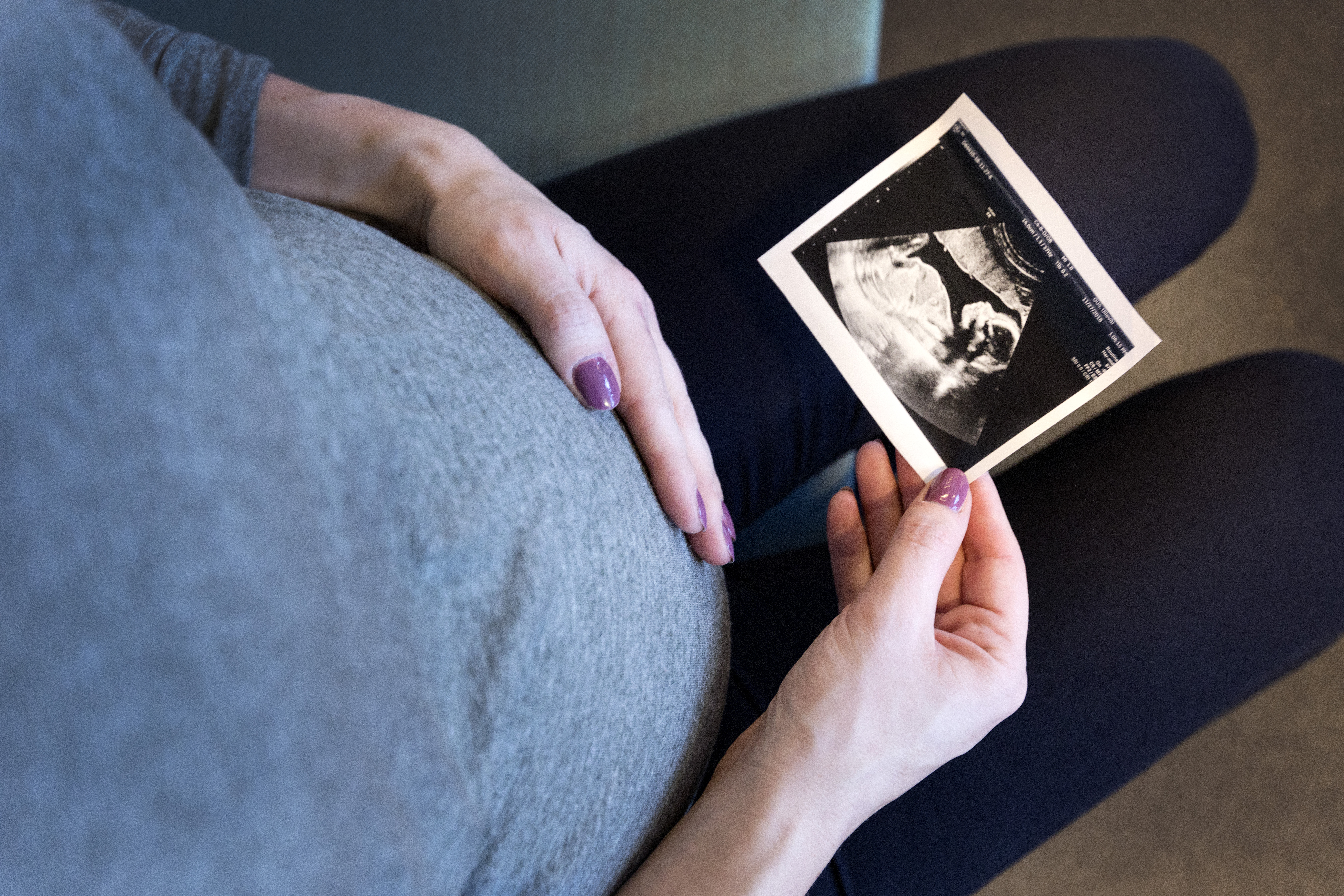 Gravid kvinna med ultraljudsbild Gravid kvinna med ultraljudsbild
