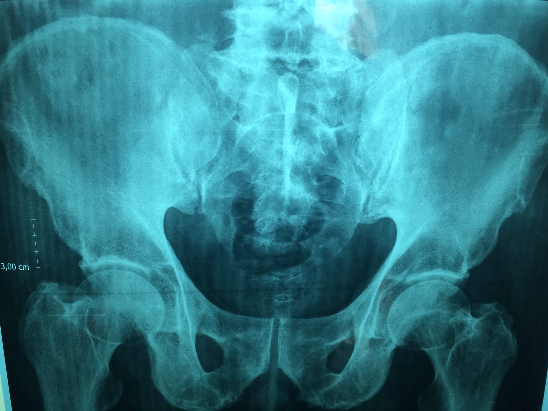 Det här får du veta av en full body scan och så mycket