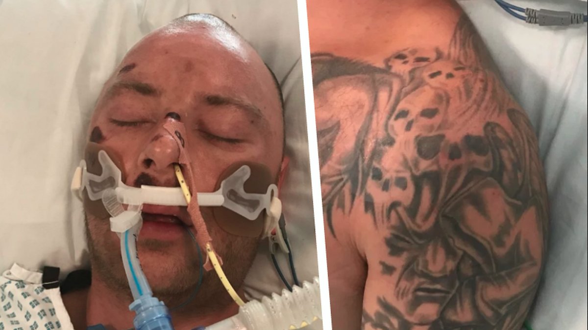 Den tatuerade mannen ligger i koma, polisen behöver hjälp att identifiera honom