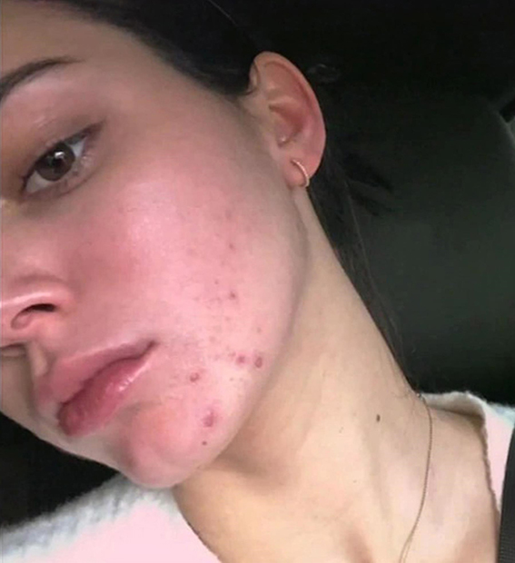Kendall Jenner Kendall Jenner