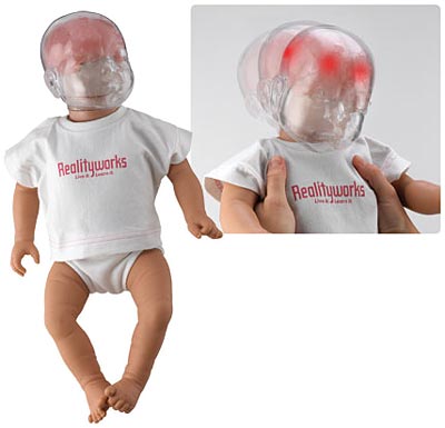 "Shaken baby syndrome" är  whiplashliknande skador som uppkommer genom att en vuxen skakar ett spädbarn.