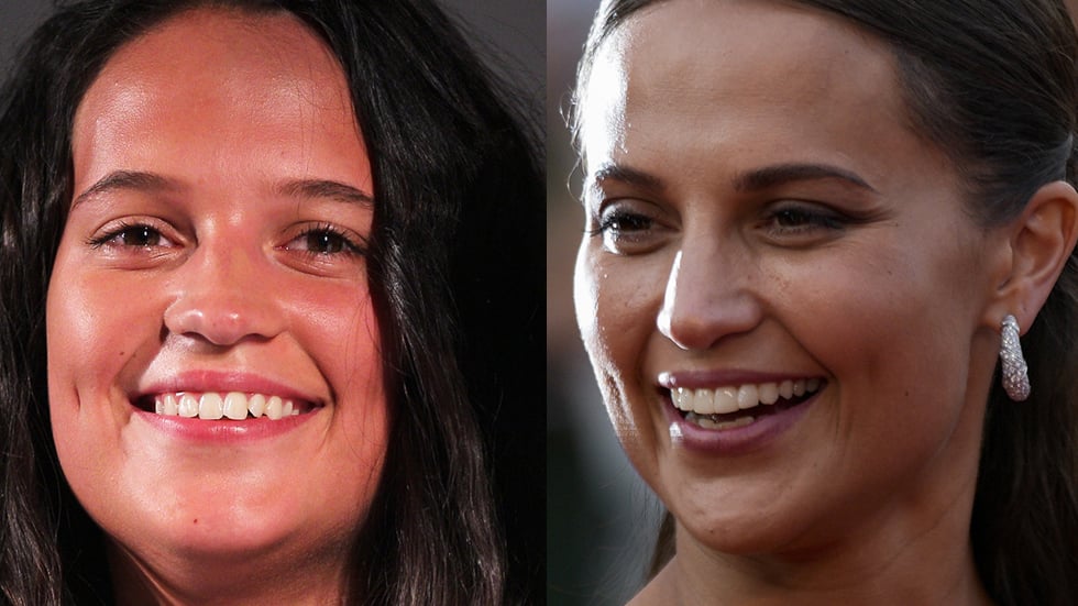 Alicia Vikander har gjort ett stort skönhetsingrepp: 