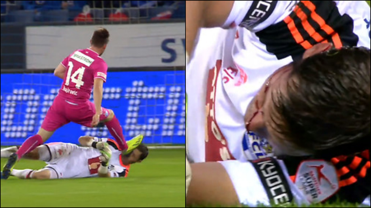 Luzerns målvakt David Zibung åkte på en otäck skada i matchen mot Grasshoppers. 