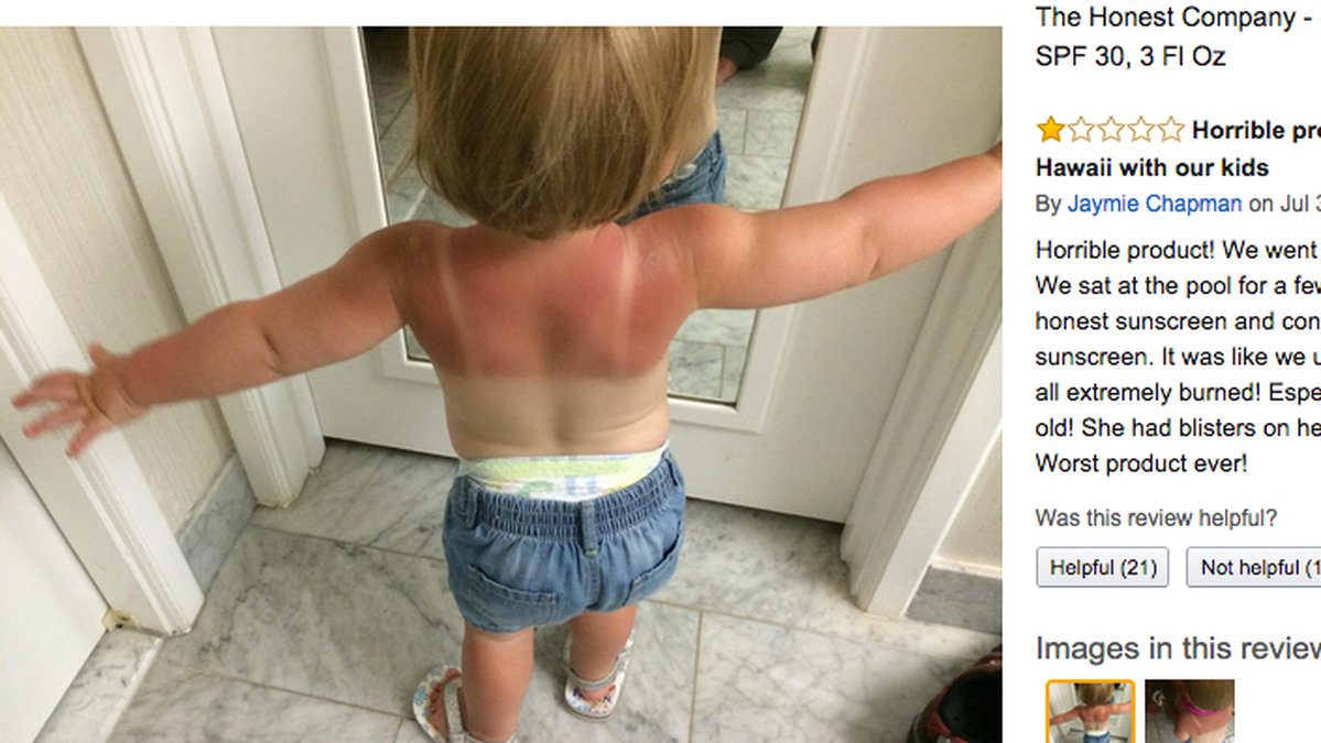 Flera missnöjda kunder recenserar solkrämen på Amazon.com och den här kvinnans dotter har bränt sig rejält i solen. 