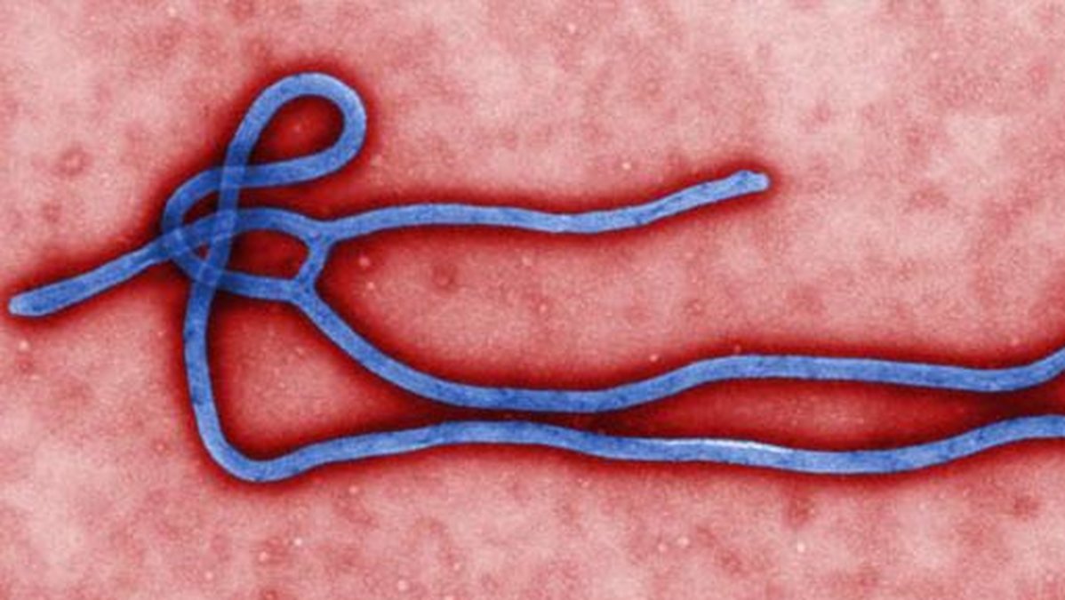 Ebola-viruset. 