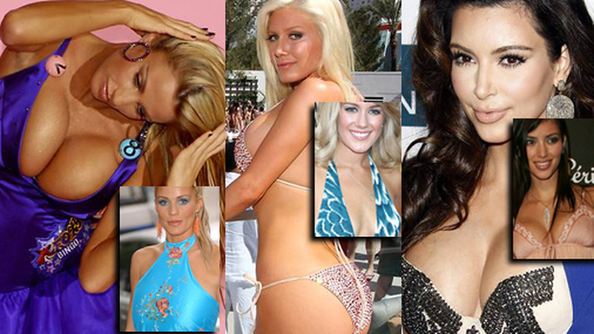 Katie Price, Heidi Montag och Kim Kardashian är bara några av stjärnorna som ångrar sina operationer.