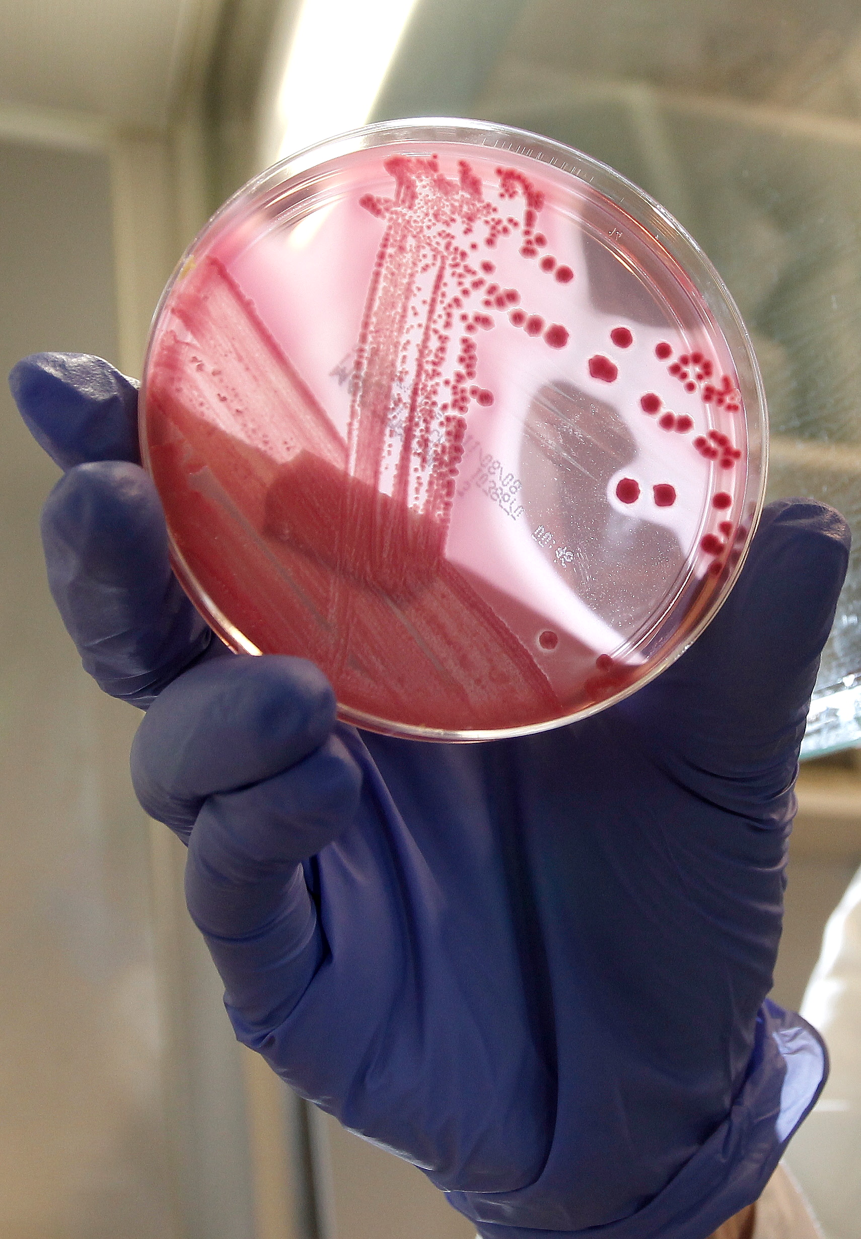 Här visar en person från sjukhuset i Hamburg upp en framodlad bakteriekultur av ehec-bakterien.