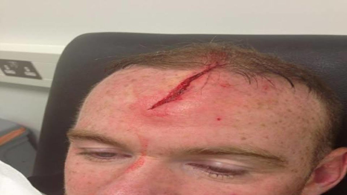Så såg Rooneys skada ut för sex dagar sedan. 