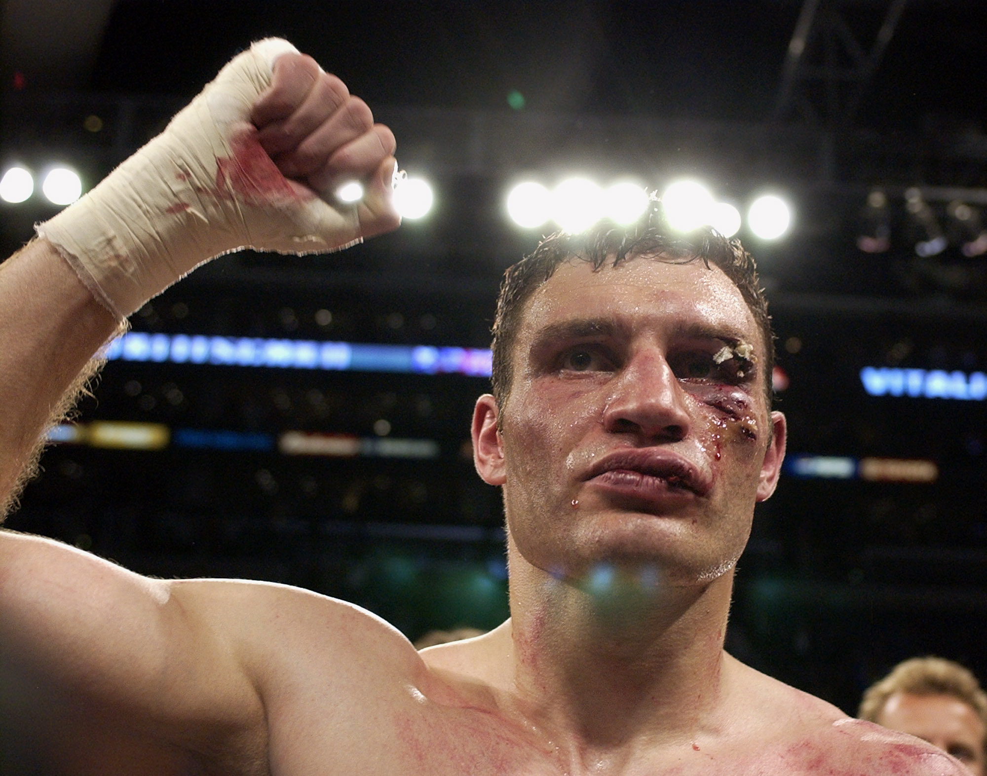 efter att Klitschko fått stora sår i ansiktet.
