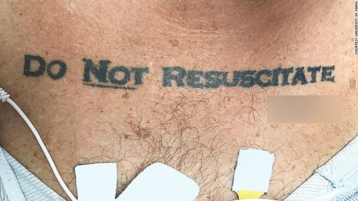 Do not resuscitate – återuppliva inte tatuering man sjukjus