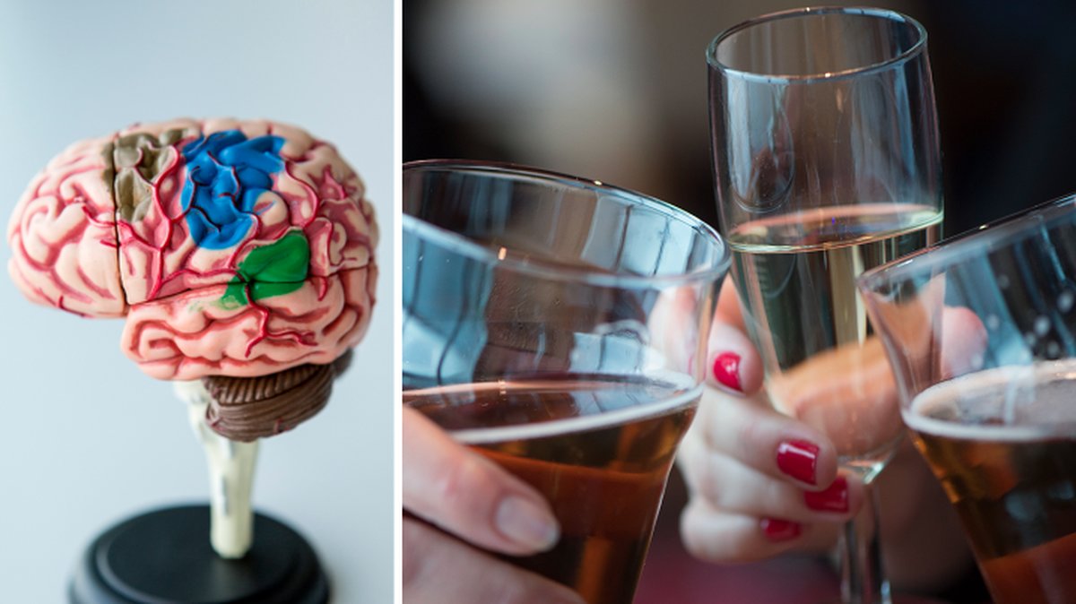 Fyra glas alkohol per dygn ökar risken för hjärnblödning – hela fem gånger. 