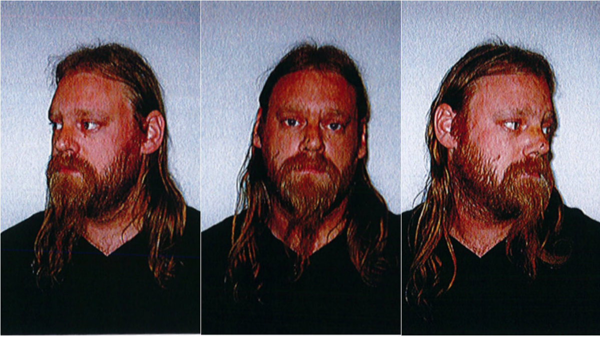 Polisens bilder på Markus Hansson två dagar efter den misstänkta misshandeln 2009. 2012 dömdes Hansson för brottet. 