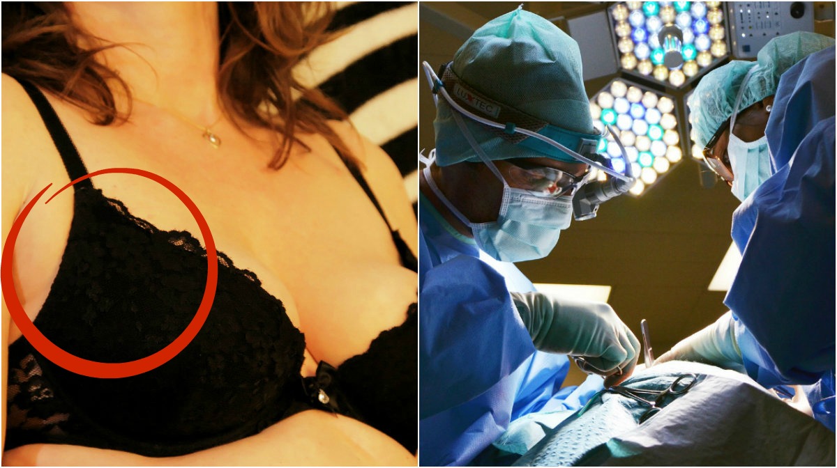 Allt fler kvinnor gör en bröstoperation.