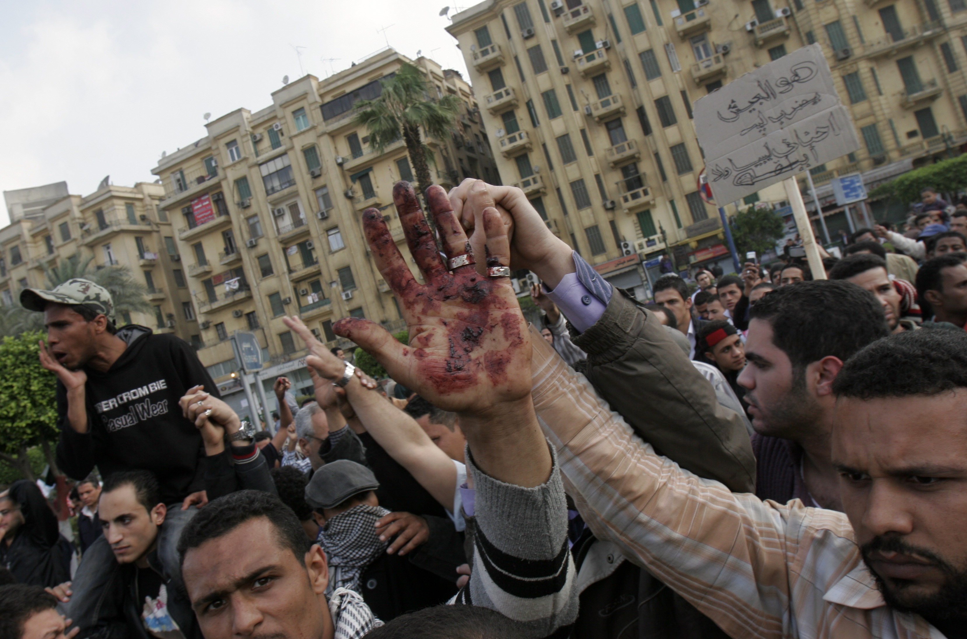 Demonstrant visar upp blodig hand efter fredagens dödsskjutningar.