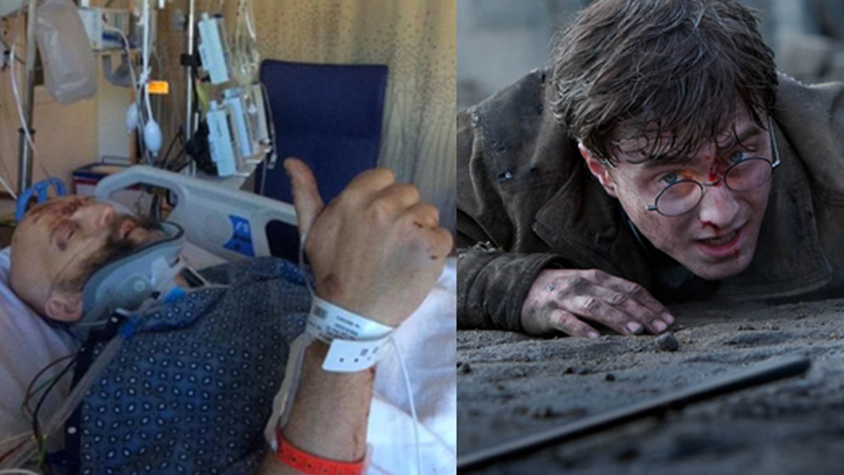 Jim Tavaré från "Harry Potter och fången från Azkaban" vårdas på sjukhus. 