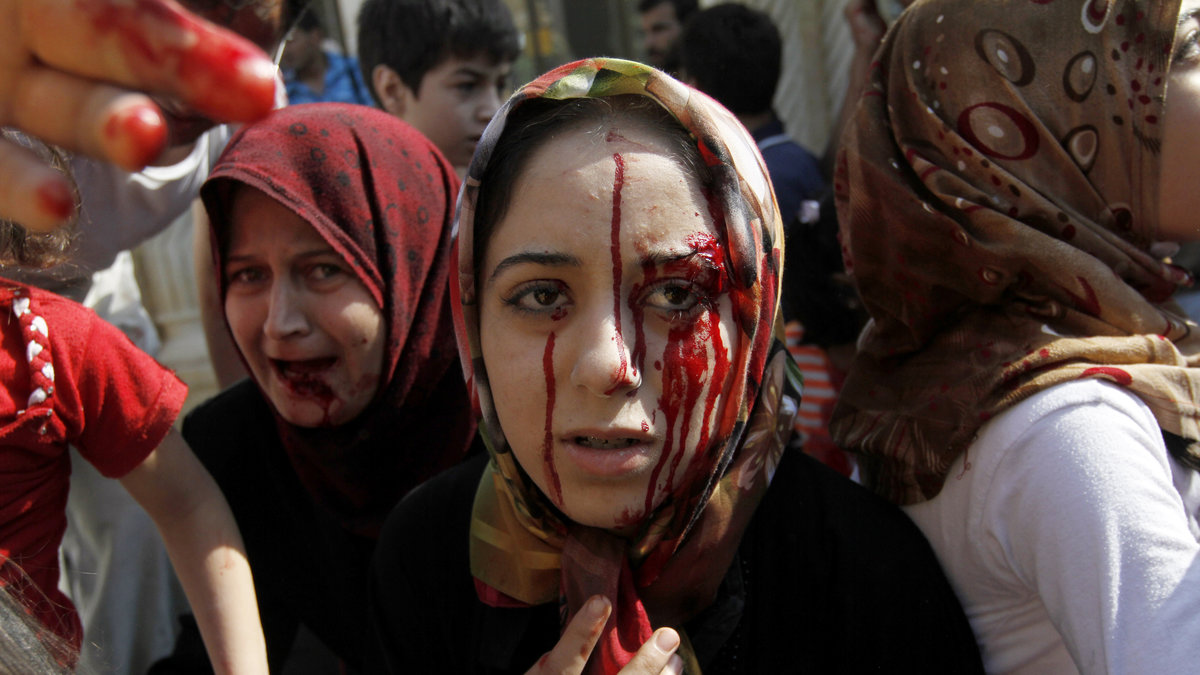 En syrisk kvinna anländer till ett fältsjukhus i Azaz efter en flygattack, augusti 2012. 