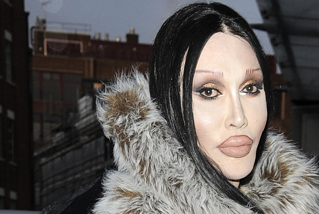 Pete Burns var en gång med i popgruppen Dead or Alive, som är mest kända för sin superhit "You Spin Me Round (Like a Record)". Nu är Burns mest känd för sina många och krångliga skönhetsoperationer. Pete Burns var en gång med i popgruppen Dead or Alive, som är mest kända för sin superhit "You Spin Me Round (Like a Record)". Nu är Burns mest känd för sina många och krångliga skönhetsoperationer.