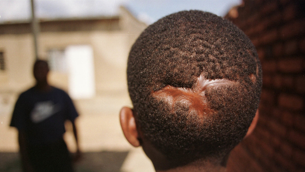 Det här är en 14 år gammal pojke från Rwanda. Under folkmordet fick han en machete i bakhuvudet och dog nästan. Han säger att han vill bli en soldat så att han kan hitta de som mördade hans föräldrar.
